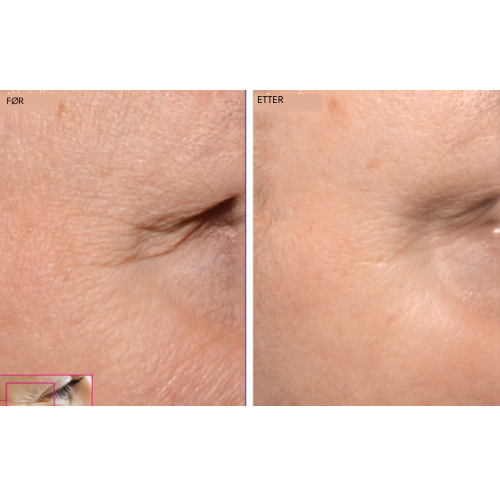 Romega® SKIN REFINE